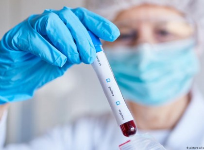 5 perce jött a hír : Végre kiderült, meddig tarthat a koronavírussal szembeni immunitás!!