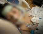 9 éves kislány az újabb áldozata a koronavírusnak.