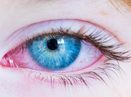 Ha ilyen tüneteket tapasztalsz magadon, már benned van a koronavírus!