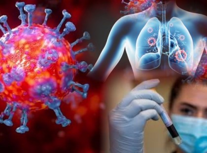 ALIG 10 perce jött a hír! Ettől félt minden magyar! Olyat jelentett be a magyar immunológus a koronavírusról, hogy a hideg rázott ki tőle….és ez bizony Önt is érinti!