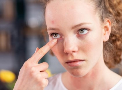 Nem mosta az ágyneműt, majd este viszketett a szeme. Amikor meglátta mi kúszik az ágyban, felsikított