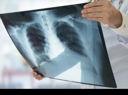 DRÁMAI hírt jelentettek be : EZT HOZZA JANUÁRRA ÉS FEBRUÁRRA A koronavírus! >>>Erre készülj, mert fel kell készülni rá…..