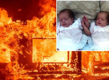 Nagyon szívszorító – Így néznek ki a 17 hónaposan, tűzben megégett hármas ikrek felnőttként