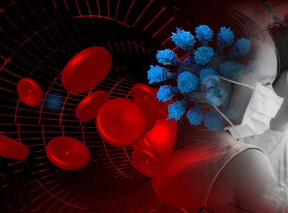 Döbbenetes új szövődményről számolnak be a koronavíruson átesettek!Mindenkit érint, tájékozódj, minél előbb >>>>ÍME A RÉSZLETEK :