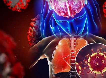 Ezt eddig nem tudták???EZ MOST MINDENT MEGVÁLTOZTAT! Döbbenetes felfedezést tettek a magyar orvosok!!!A koronavírus nem a levegőből kerül a tüdőbe – >>