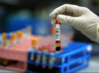 FIGYELEM! Ha vérételre, vizeletvizsgálatra, laborvizsgálatra mész legközelebb, erről jobb, ha tudsz!