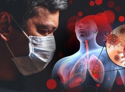 10 perce jött a hír! Ez az 5 kiütéstípus előre jelezheti a koronavírust!!! >>>> EZEKET KELL FIGYELNI A BŐRÖN, A KEZEKEN, LÁBAKON, TÖRZSÖN! >>>>