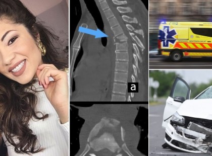 Gáspár Evelin csigolyatörést szenvedett az autóbalesetben, és ez még nem minden!