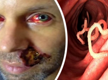 Durva: agyevő kórokozók kezdtek el terjedni világszerte: borzalmas fertőzések ütheti fel a fejüket az emberek között?