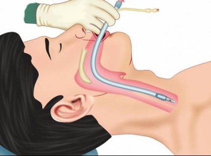 A doktornő elmondta az igazságot !A tüdőgyógyász szerint ebbe halnak bele valójában a kórházban fekvő betegek