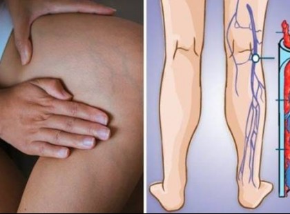 A vérrög 10 korai figyelmeztető jele