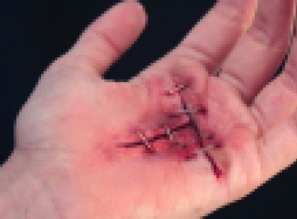 Terjed a tryphophobia ! Mindenki ledöbbent arccal figyelte a lány kezét, majd jött egy olyan csavar, hogy te is csak pislogni fogsz!