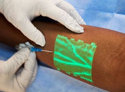 Az új találmány megmutatja, hol van a véna. Nincs több mellé szurkálás, így működik