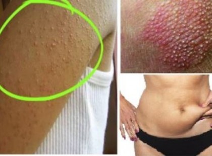 Ez az 5 tünet a trombózisra utal, és azonnal orvoshoz kell fordulni!