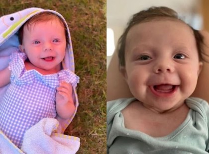 Nincsenek szavak: egy 6 hónapos kislány teste lassan kősziklává változik!