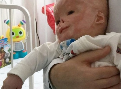 Az ápoló a kiságyra fektette a babát. Amikor néhány perccel később megnézte az arcát, sikított a rémülettől.