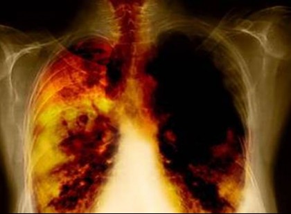 A magyarok nagy része naponta issza, pedig rákot okoz!