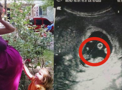 Bámulatos! Amikor bevitték a kórházba, az orvosok féltek hozzáérni: soha nem láttunk még ilyen csodát!