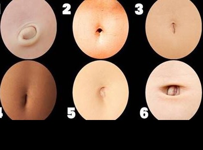 Köldökünk formája kikotyogja, milyen a személyiségünk: