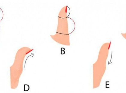 Így mutatja meg hüvelykujjad formája és típusa, hogy milyen személyiség vagy!