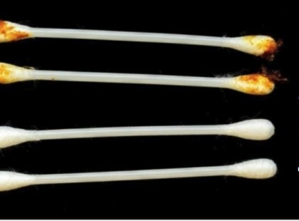 Fülünk megmutatja, hogy áll az egészségünk: 8 jel, ami időben tudtunkra adja, ha baj van