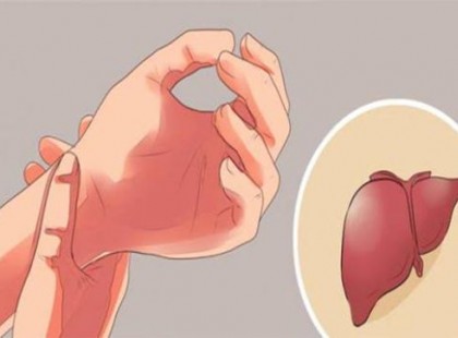 A MÁJUNK nem fáj, hamikor megbetegszik: Mégis létezik 5 olyan tünet, ami előre jelzi a nagyobb bajt