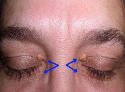 Különösen figyelj ezekre a jelekre, mert az életed múlhat rajta!