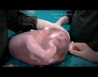 Egy spanyol kórházban videózták le a lélegzetelállító jelenséget !Döbbenetes felvétel erre körülbelül 80000:1-hez az esély rá: mozgó baba a magzatburokban!-videó