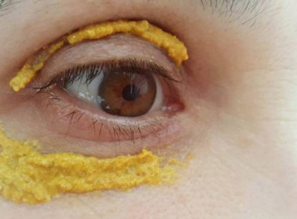 Kurkumát kente a szeme köré, 10 perccel később hihetetlen dolgot tapasztalt!