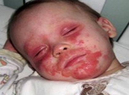 “Már akkora fájdalmai voltak a kisfiúnknak, hogy a halálért könyörgött nekünk” – Ám ami ezek után történt az megmutatta, hogy miért is ember az ember! Remélem sokakhoz eljut történetünk!