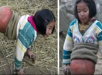 A “Kosárlabda lány” elvesztette mindkét a lábát egy csúnya balesetben – 10 évvel később ő egy milliomos, és így néz ki!