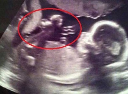 Ultrahangra mentek, de az arcukra fagyott a mosoly attól, amit ott láttak!