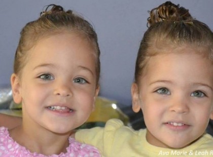 7 éves korukban a világ legszebb ikreinek tartották őket! Így néznek ki most (képek a cikkben)