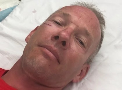 Nyilatkozott Csollány Szilveszter állapotáról Dr. Novák Hunor : 