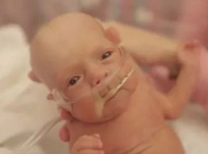 3 és fél hónaposan született meg ez a tündéri kisfiú! Nézd meg, miként reagál édesanyja, mikor először veszi karjaiba!