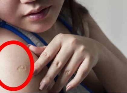 Ha neked is meg van ennek a védőoltásnak a helye, most nagyon figyelj!