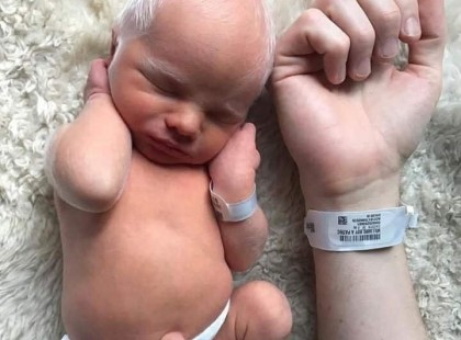 Bence baba hófehér hajjal született.. Még a tapasztalt orvosok is csak néztek, hogy mi az oka