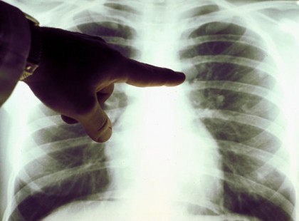 A magyarok nagy része naponta issza, pedig rákot okoz!