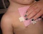 Gyógyító borogatás: meggyógyítja az erős köhögést, eltávolítja a váladékot a tüdőből mindössze 1 éjszaka alatt!