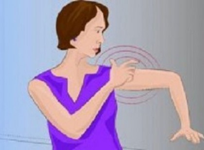 Agyvérzés előtt egy hónappal ezeket a jeleket küldi az emberi test! Nagyon figyelj!