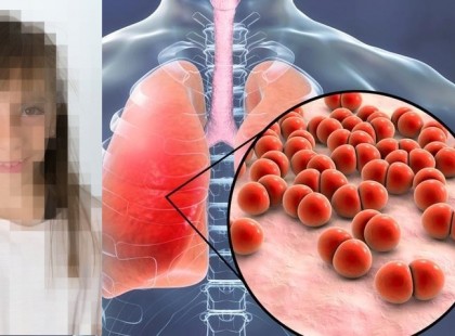 Most jelentették be : ÉLETBEVÁGÓ!!! Ez történt a gyermekekkel, akiknél a covid-oltás szívizomgyulladást okozott !A tünetek jellemzően az oltást követően 2 nappal léptek fel