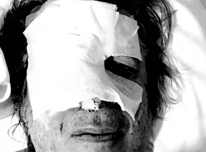 Nagy a baj!Kórházba került Bródy János! A fél arca odavan.... - fotó