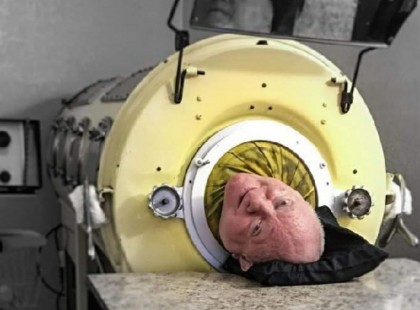 65 éve él vastüdővel ez a férfi.. 6 éves korában került bele, és benne öregedett meg