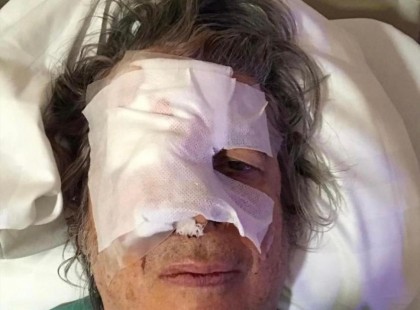 1 perce jött a hír Bródy Jánosról. A menedzsere közölte