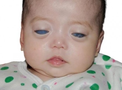 Senki sem fogadta örökbe a kékes-szürke szemű kislányt. Ám felbukkant egy különleges fénykép!