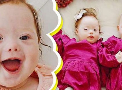 Az édesanya világra hozza gyönyörű ikreit: kisvártatva az orvos becsukja az ajtót, és így szól az anyához: “Részvétem”