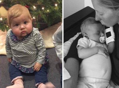 A 3 hónapos baba hasa egyre nagyobb és nagyobb lett. Az orvos a kivizsgálást követően jön rá a szörnyű igazságra