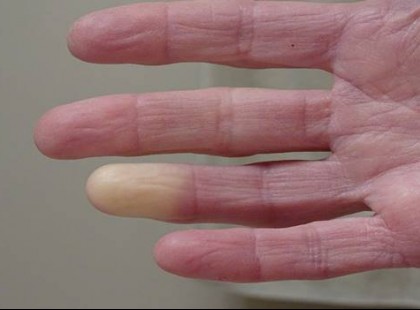 A halál jelei testünkön is megmutatkozhatnak. Íme a leggyakoribb tünetek