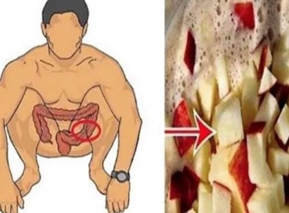 Tisztítsd ki a vastagbeled ezzel, és 20 nap alatt akár több kilót is ledobhatsz!