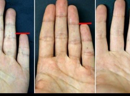 A kisujjad hossza elmondja rólad, hogy milyen ember vagy